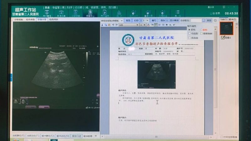 上海女性体检中心报价对比：揭秘体检套餐背后的真相